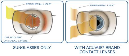 UV-blocking with ACUVUE® 